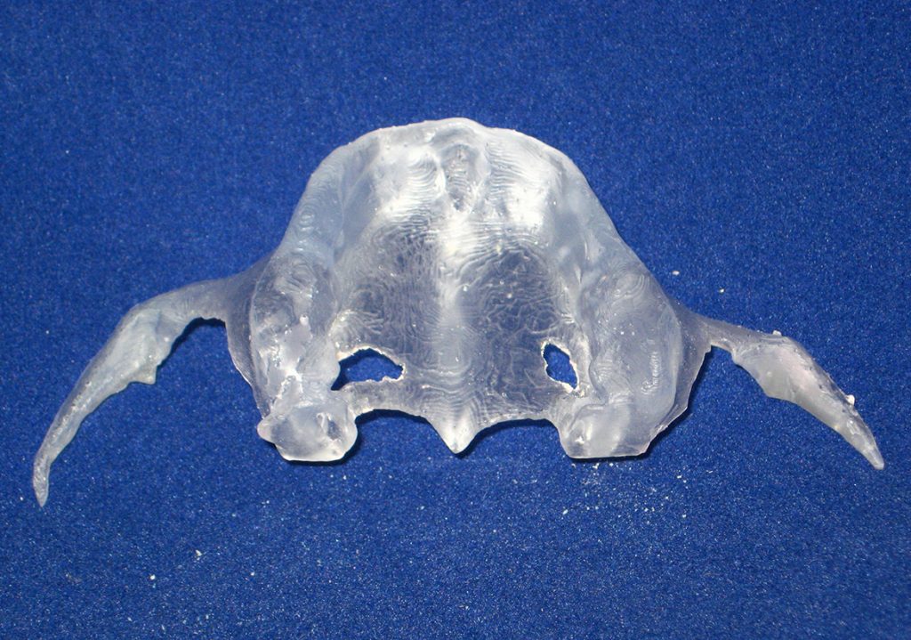 Placement of a Modified Subperiosteal Implant A Clinical Solution to