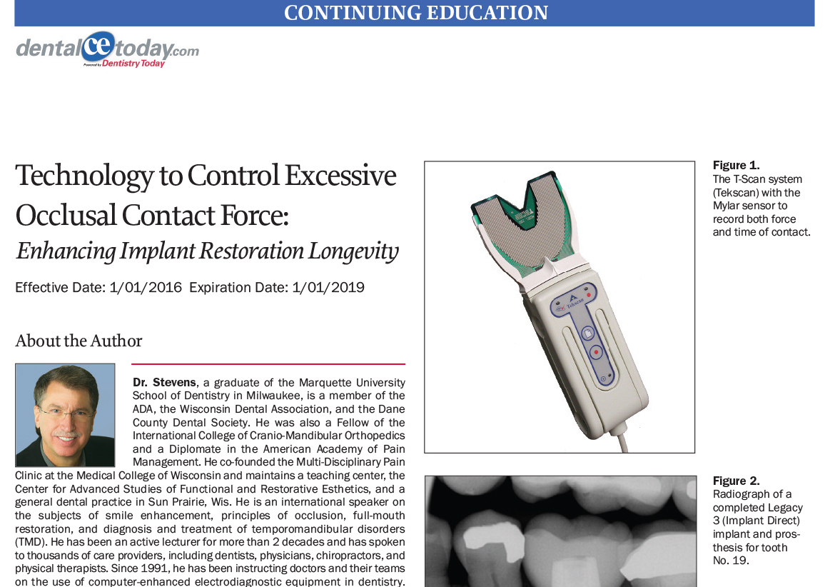 Technology to Control Excessive Occlusal Contact Force Dentistry Today CE