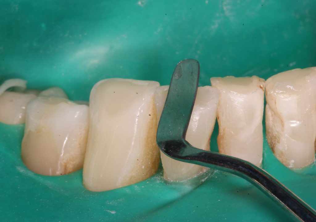 Understanding Light Curing, Part 2 (174) Dentistry Today CE