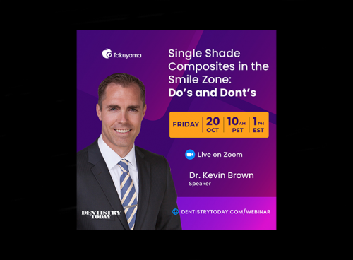 Single Shade Composites in the Smile Zone: Do’s and Don’ts